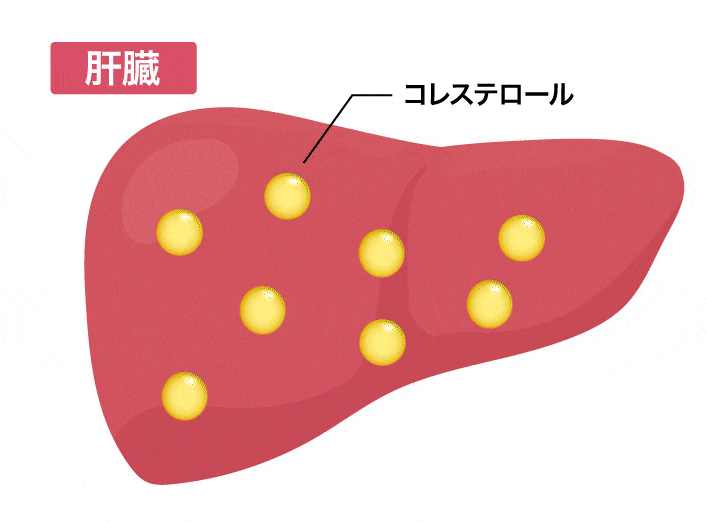 オロチサールがコレステロールに効く秘密1。コレステロールの生成を抑制